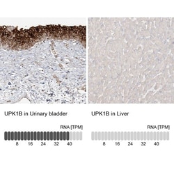 Uroplakin Ib Antibody, Novus Biologicals:Antibodies:Primary Antibodies